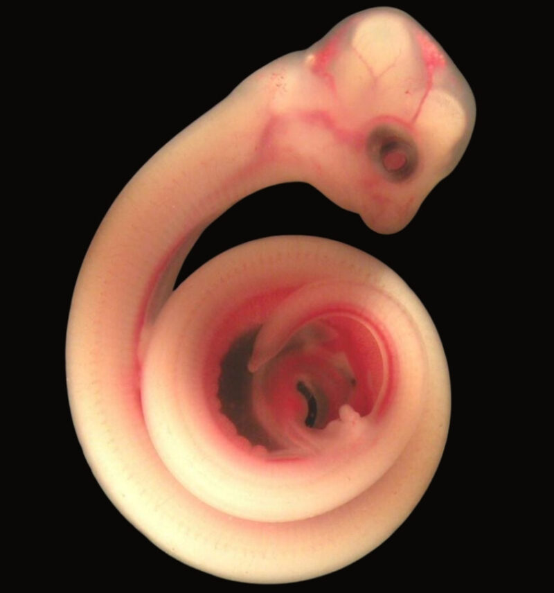 Development of the snake in womb